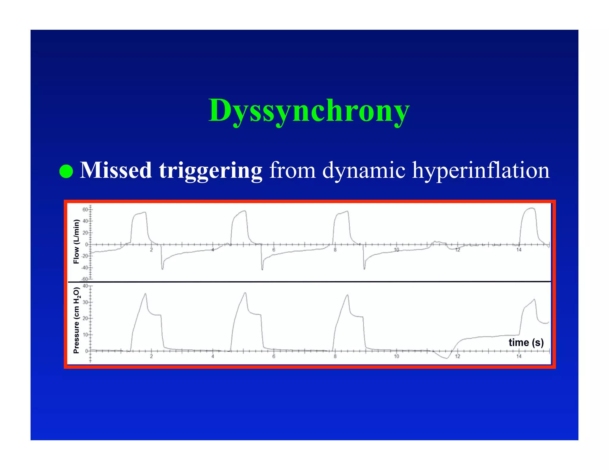 Dyssynchrony
  Missed   triggering from dynamic hyperinflation
 