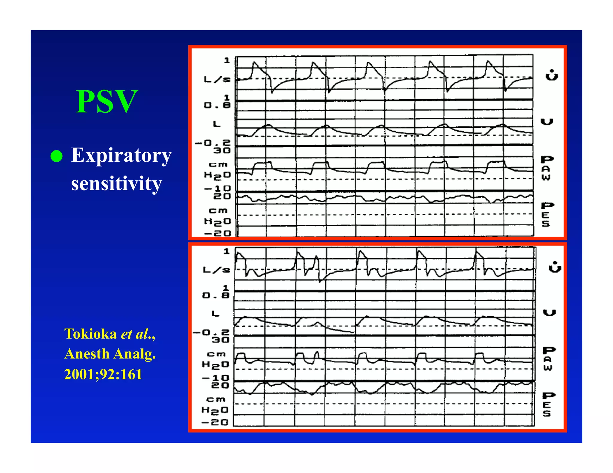 PSV
    Expiratory
     sensitivity




 Tokioka et al.,
 Anesth Analg.
 2001;92:161
 