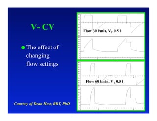 Optimizing Critical Care Ventilation: What can we learn from Ventilator ...