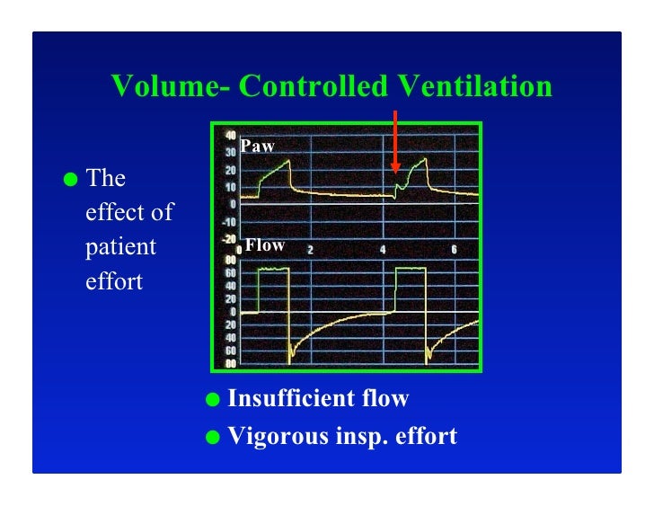 Optimizing Critical Care Ventilation What can we learn from Ventilat…