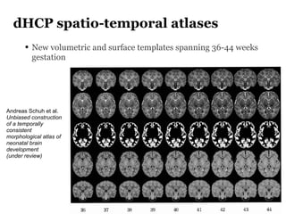 dHCP spatio-temporal atlases
• New volumetric and surface templates spanning 36-44 weeks
gestation
Andreas Schuh et al.
Unbiased construction
of a temporally
consistent
morphological atlas of
neonatal brain
development
(under review)
 