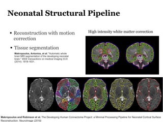 Neonatal Structural Pipeline
Makropoulos and Robinson et al. The Developing Human Connectome Project: a Minimal Processing...
