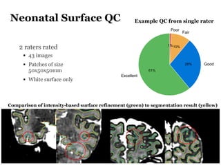 Neonatal Surface QC
2 raters rated
• 43 images
• Patches of size
50x50x50mm
• White surface only
Comparison of intensity-b...