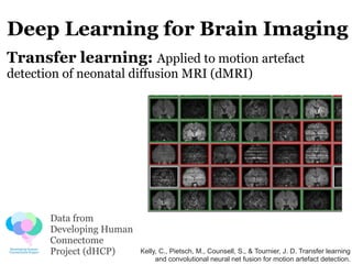 Deep Learning for Brain Imaging
Transfer learning: Applied to motion artefact
detection of neonatal diffusion MRI (dMRI)
D...