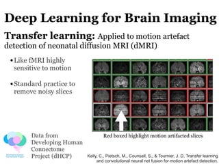 Deep Learning for Brain Imaging
Transfer learning: Applied to motion artefact
detection of neonatal diffusion MRI (dMRI)
•...