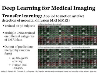 Deep Learning for Medical Imaging
Transfer learning: Applied to motion artefact
detection of neonatal diffusion MRI (dMRI)...