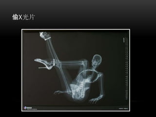 偷X光片
 