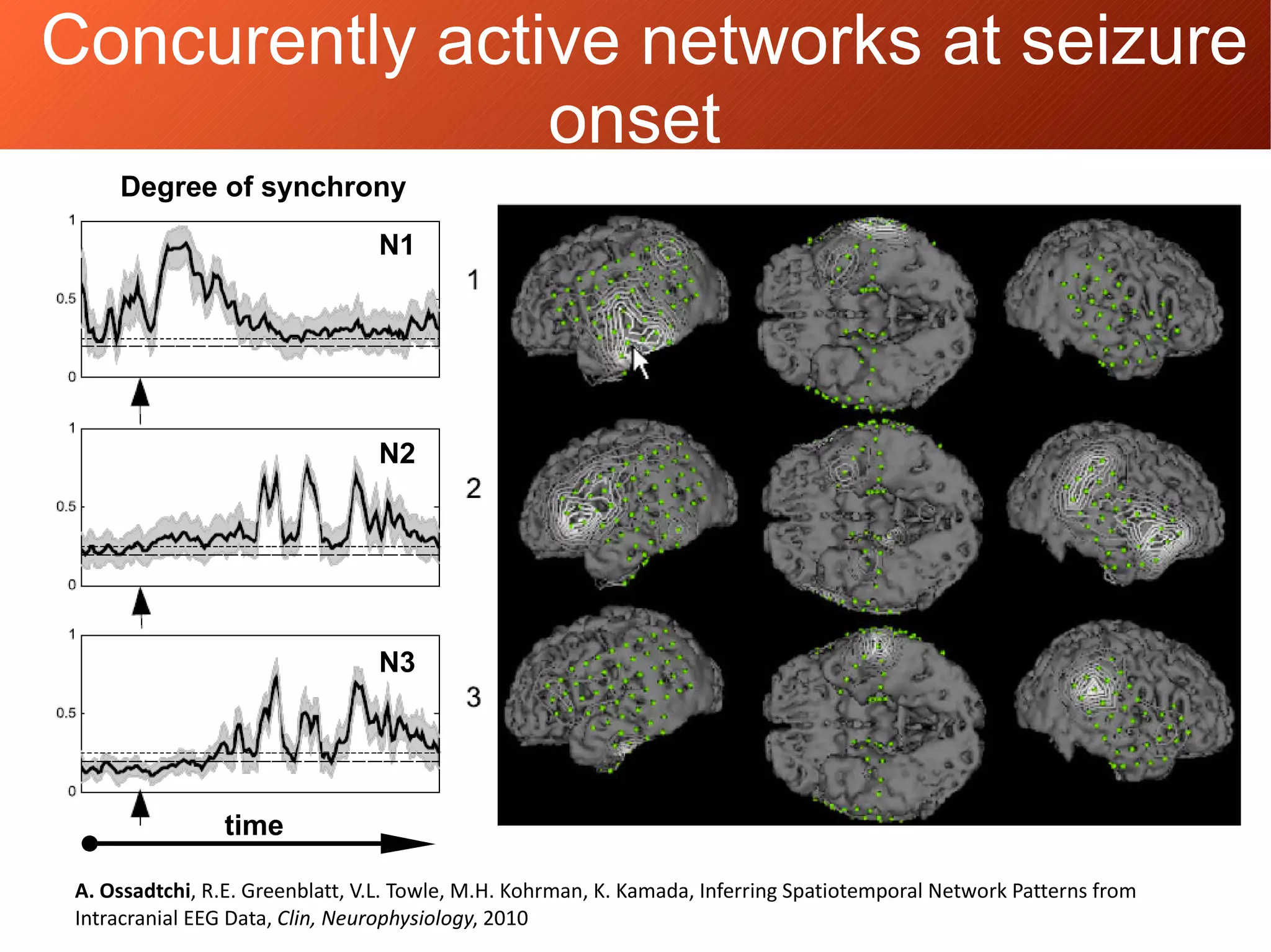 Concurently active networks at seizure
onset
A. Ossadtchi, R.E. Greenblatt, V.L. Towle, M.H. Kohrman, K. Kamada, Inferring Spatiotemporal Network Patterns from
Intracranial EEG Data, Clin, Neurophysiology, 2010
Degree of synchrony
time
N1
N2
N3
 