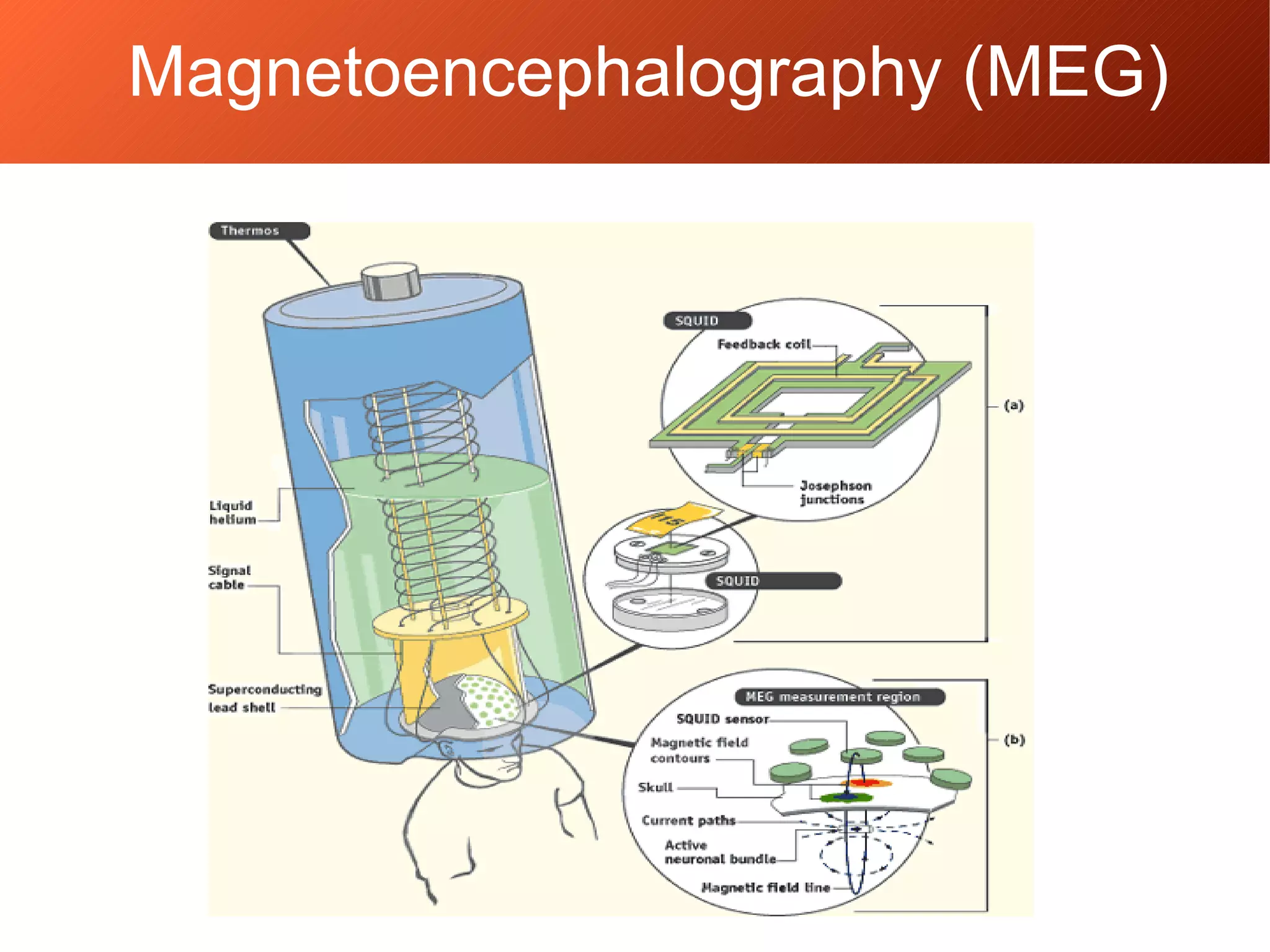 Magnetoencephalography (MEG)
 