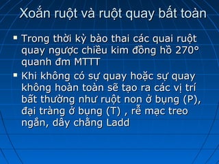 Xoắn ruột và ruột quay bất toànXoắn ruột và ruột quay bất toàn
 Trong thời kỳ bào thai các quai ruộtTrong thời kỳ bào thai các quai ruột
quay ngược chiều kim đồng hồ 270°quay ngược chiều kim đồng hồ 270°
quanh đm MTTTquanh đm MTTT
 Khi không có sự quay hoặc sự quayKhi không có sự quay hoặc sự quay
không hoàn toàn sẽ tạo ra các vị tríkhông hoàn toàn sẽ tạo ra các vị trí
bất thường như ruột non ở bụng (P),bất thường như ruột non ở bụng (P),
đại tràng ở bụng (T) , rễ mạc treođại tràng ở bụng (T) , rễ mạc treo
ngắn, dây chằng Laddngắn, dây chằng Ladd
 