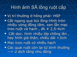 Hình ảnh SÂ lồng ruột cấpHình ảnh SÂ lồng ruột cấp
 Vị trí thường ở hông phải- HSPVị trí thường ở hông phải- HSP
 Cắt ngang qua búi lồng:Hình trònCắt ngang qua búi lồng:Hình tròn
nhiều vòng đồng tâm, xen lẫn mạcnhiều vòng đồng tâm, xen lẫn mạc
treo ruột và hạch , đk # 2,5-4cmtreo ruột và hạch , đk # 2,5-4cm
 Cắt dọc: hình nhiều lớp chồng lên ,Cắt dọc: hình nhiều lớp chồng lên ,
hay hình giả thận, chiều dài >3cmhay hình giả thận, chiều dài >3cm
 Mạc treo ruột có nhiều hạchMạc treo ruột có nhiều hạch
 Các quai ruột còn lại từ bình thườngCác quai ruột còn lại từ bình thường
--> ứ dịch tăng nhu động--> ứ dịch tăng nhu động
 