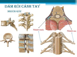 ĐÁM RỐI CÁNH TAY
NGUỒN GỐC
Nhánh trƣớc
Nhánh sau
 