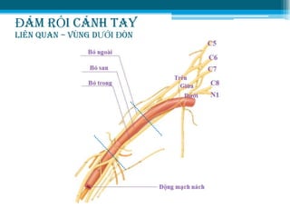 ĐÁM RỐI CÁNH TAY
LIÊN QUAN – VÙNG DƢỚI ĐÒN
 