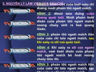 HÌNH 1: Maët caét cuûa loaïi caàu chì
duøng moät phaàn töû ngaét maïch.
HÌNH 2: döoùi taùc duïng cuûa
doøng quaù taûi. Moät phaàn tieát
dieän cuûa phaàn töû ngaét maïch
noùng chaûy sinh ra hoà quang
ñieän.
HÌNH 3: phaàn töû ngaét maïch ñôn
cuûa caàu chì taïo ngaét maïch, sau
khi xaûy ra söï coá quaù taûi.
HÌNH 4: Khi xaûy ra söï coá ngaén
maïch, vaøi tieát dieän cuûa phaàn
töû ngaét maïch bò ñoát noùng
chaûy töùc thì.
HÌNH 5: phaàn töû ngaét maïch ñôn
cuûa caàu chì taïo ngaét maïch, sau
17
2. NGUYÊN LÝ LÀM VIỆC CỦA CẦU CHÌ
 
