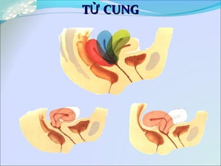 T CUNGỬT CUNGỬ
 