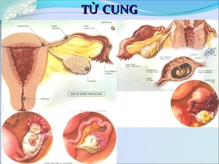 T CUNGỬT CUNGỬ
 