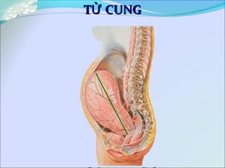 32cm
T CUNGỬT CUNGỬ
 