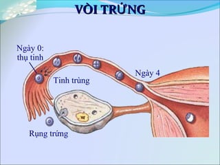 VÒI TR NGỨVÒI TR NGỨ
Tinh trùng
Ngày 0:
thụ tinh
Rụng trứng
Ngày 4
 