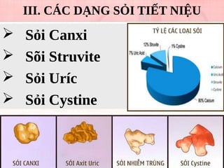 III. CÁC DẠNG SỎI TIẾT NIỆU
 Sỏi Canxi
 Sõi Struvite
 Sỏi Uríc
 Sỏi Cystine
 