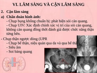 2. Cận lâm sàng
a) Chẩn đoán hình ảnh:
- Chụp bụng không chuẩn bị: phát hiện sỏi cản quang.
- Chụp UIV: Xác định chính xác vị trí của sỏi cản quang,
không cản quang đồng thời đánh giá được chức năng thận
từng bên.
- Chụp thận ngược dòng (UPR
- Chụp bể thận, niệu quản qua da và qua bể thận
- Siêu âm
- Soi bàng quang
VI. LÂM SÀNG VÀ CẬN LÂM SÀNG
Tải bản FULL (18 trang): https://bit.ly/3myRN6J
Dự phòng: fb.com/TaiHo123doc.net
 