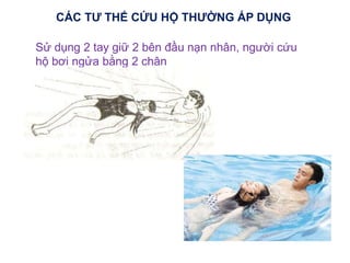 Sử dụng 2 tay giữ 2 bên đầu nạn nhân, người cứu
hộ bơi ngửa bằng 2 chân
CÁC TƯ THẾ CỨU HỘ THƯỜNG ÁP DỤNG
 