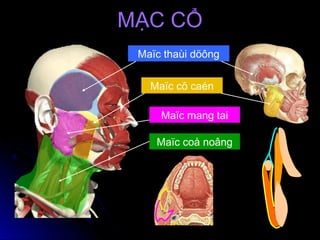 Maïc thaùi döông
Maïc cô caén
Maïc mang tai
Maïc coå noâng
MẠC CỔMẠC CỔ
 