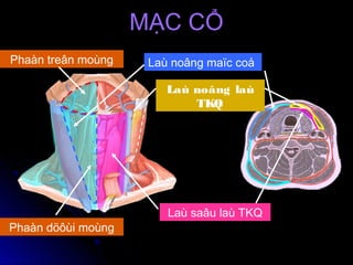 Laù noâng maïc coåPhaàn treân moùng
Phaàn döôùi moùng
Laù noâng laù
TKQ
Laù saâu laù TKQ
MẠC CỔMẠC CỔ
 