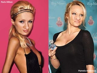 Paris Hilton




               Pamela Anderson
 