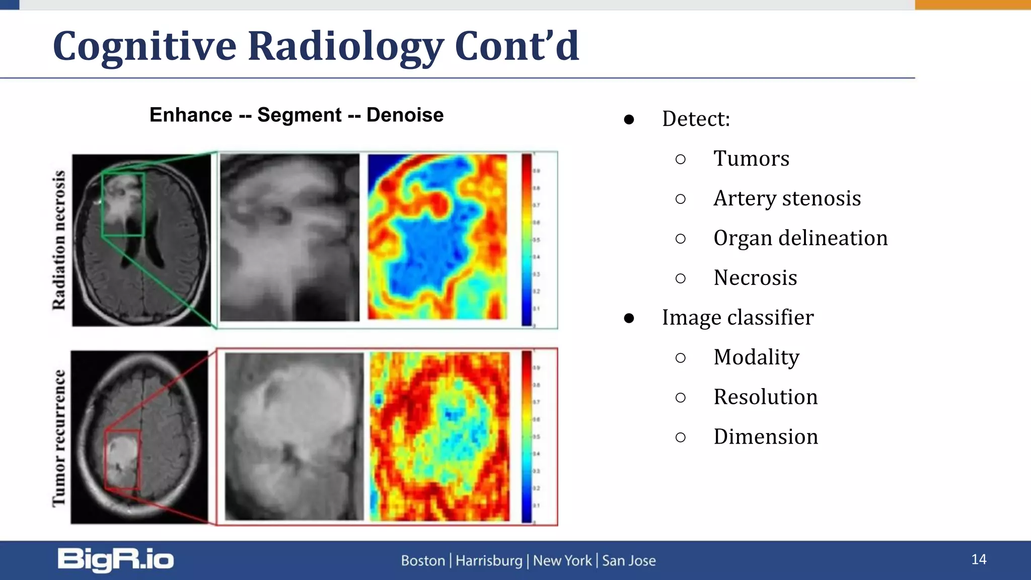 Cognitive Radiology Cont’d
14
● Detect:
○ Tumors
○ Artery stenosis
○ Organ delineation
○ Necrosis
● Image classifier
○ Modality
○ Resolution
○ Dimension
Enhance -- Segment -- Denoise
 