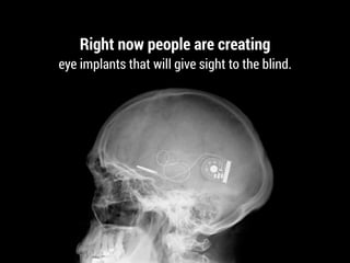 Right now people are creating
eye implants that will give sight to the blind.
 