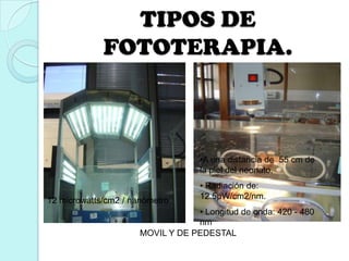 12 microwatts/cm2 / nanómetro
•A una distancia de 55 cm de
la piel del neonato.
• Radiación de:
12.5µW/cm2/nm.
• Longitud de onda: 420 - 480
nm
TIPOS DE
FOTOTERAPIA.
MOVIL Y DE PEDESTAL
 