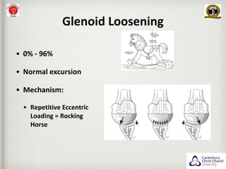 Glenoid in Total Shoulder Replacement