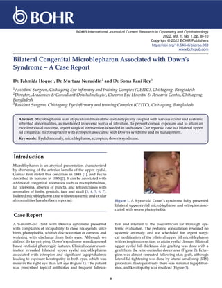 BOHR International Journal of Current Research in Optometry and Ophthalmology
2022, Vol. 1, No. 1, pp. 8–10
Copyright © 2022 BOHR Publishers
https://doi.org/10.54646/bijcroo.003
www.bohrpub.com
Bilateral Congenital Microblepharon Associated with Down’s
Syndrome – A Case Report
Dr. Fahmida Hoque1, Dr. Murtuza Nuruddin2 and Dr. Soma Rani Roy3
1Assistant Surgeon, Chittagong Eye infirmary and training Complex (CEITC), Chittagong, Bangladesh
2Director, Academics & Consultant Ophthalmologist, Chevron Eye Hospital & Research Centre, Chittagong,
Bangladesh
3Resident Surgeon, Chittagong Eye infirmary and training Complex (CEITC), Chittagong, Bangladesh
Abstract. Microblepharon is an atypical condition of the eyelids typically coupled with various ocular and systemic
inherited abnormalities, as mentioned in several works of literature. To prevent corneal exposure and to attain an
excellent visual outcome, urgent surgical intervention is needed in such cases. Our reported case is a bilateral upper
lid congenital microblepharon with ectropion associated with Down’s syndrome and its management.
Keywords: Eyelid anomaly, microblepharon, ectropion, down’s syndrome.
Introduction
Microblepharon is an atypical presentation characterized
by shortening of the anterior lamella of the upper eyelid.
Cornaz first stated this condition in 1848 [1], and Fuchs
described its features in 1885 [2]. It can be associated with
additional congenital anomalies such as microphthalmos,
lid coloboma, absence of puncta, and tetrastichiasis with
anomalies of limbs, genitals, face and skull [3, 4, 5, 6, 7].
Isolated microblepharon case without systemic and ocular
abnormalities has also been reported.
Case Report
A 9-month-old child with Down’s syndrome presented
with complaints of incapability to close his eyelids since
birth, photophobia, whitish discolouration of corneas, and
watering with discharge from both eyes. Although we
did not do karyotyping, Down’s syndrome was diagnosed
based on facial phenotypic features. Clinical ocular exam-
ination revealed bilateral upper eyelid microblepharon
associated with ectropion and significant lagophthalmos
leading to exposure keratopathy in both eyes, which was
more in the right eye than left eye (Figure 1). The patient
was prescribed topical antibiotics and frequent lubrica-
Figure 1. A 9-year-old Down’s syndrome baby presented
bilateral upper eyelid microblepharon and ectropion asso-
ciated with severe photophobia.
tion and referred to the paediatrician for thorough sys-
temic evaluation. The pediatric consultation revealed no
systemic anomaly, and we scheduled for urgent surgi-
cal modification of the bilateral upper lid microblepharon
with ectropion correction to attain eyelid closure. Bilateral
upper eyelid full-thickness skin grafting was done with a
graft from the retro-auricular donor area (Figure 2). Ectro-
pion was almost corrected following skin graft, although
lateral lid tightening was done by lateral tarsal strip (LTS)
procedure. Postoperatively there was minimal lagophthal-
mos, and keratopathy was resolved (Figure 3).
8
 