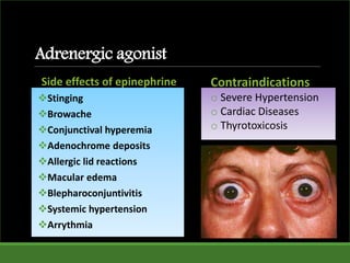 Adrenergic agonist
Side effects of epinephrine
Stinging
Browache
Conjunctival hyperemia
Adenochrome deposits
Allergic lid reactions
Macular edema
Blepharoconjuntivitis
Systemic hypertension
Arrythmia
Contraindications
o Severe Hypertension
o Cardiac Diseases
o Thyrotoxicosis
 