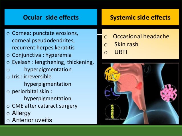 Acetazolamide Side Effects Glaucoma