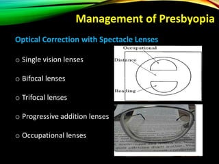 Optical Correction with Spectacle Lenses
o Single vision lenses
o Bifocal lenses
o Trifocal lenses
o Progressive addition lenses
o Occupational lenses
Management of Presbyopia
 