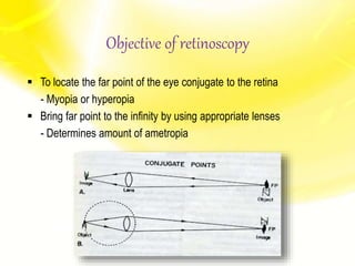  To locate the far point of the eye conjugate to the retina
- Myopia or hyperopia
 Bring far point to the infinity by using appropriate lenses
- Determines amount of ametropia
Objective of retinoscopy
 