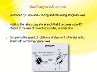 Straddling the cylinder axis
o Introduced by Copeland – finding and bracketing astigmatic axis
o Rotating the retinoscopy streak such that it becomes align 450
oblique to the axis of correcting cylinder, to either side
o Comparing the speed of rotation and alignment of fundus reflex
streak with correcting cylinder axis
 