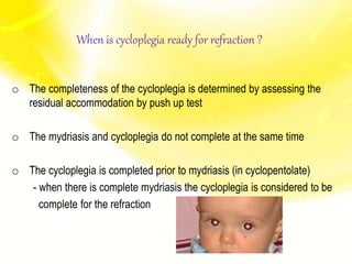 When is cycloplegia ready for refraction ?
o The completeness of the cycloplegia is determined by assessing the
residual accommodation by push up test
o The mydriasis and cycloplegia do not complete at the same time
o The cycloplegia is completed prior to mydriasis (in cyclopentolate)
- when there is complete mydriasis the cycloplegia is considered to be
complete for the refraction
 