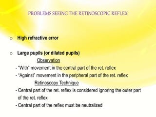 PROBLEMS SEEING THE RETINOSCOPIC REFLEX
o High refractive error
o Large pupils (or dilated pupils)
Observation
- “With” movement in the central part of the ret. reflex
- “Against” movement in the peripheral part of the ret. reflex
Retinoscopy Technique
- Central part of the ret. reflex is considered ignoring the outer part
of the ret. reflex
- Central part of the reflex must be neutralized
 