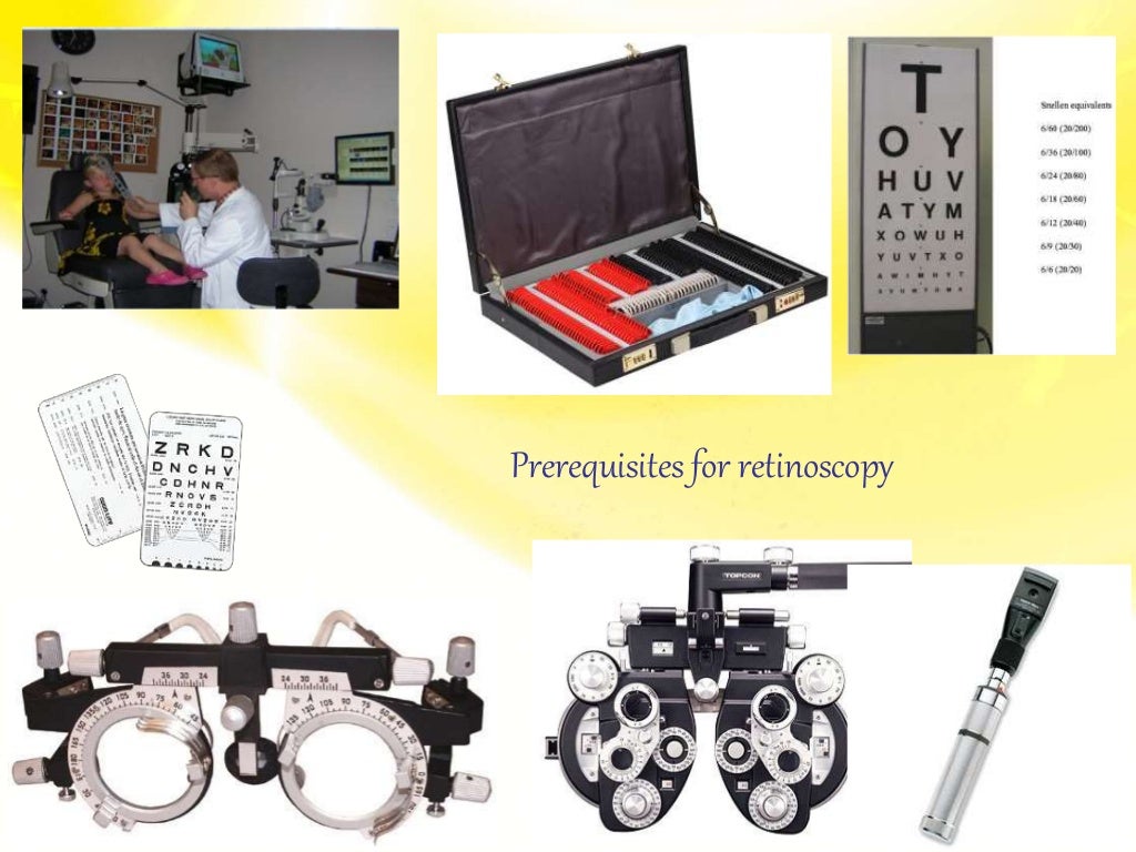 Retinoscopy/ Objective Refraction / Retinoscopy of eye (Principle