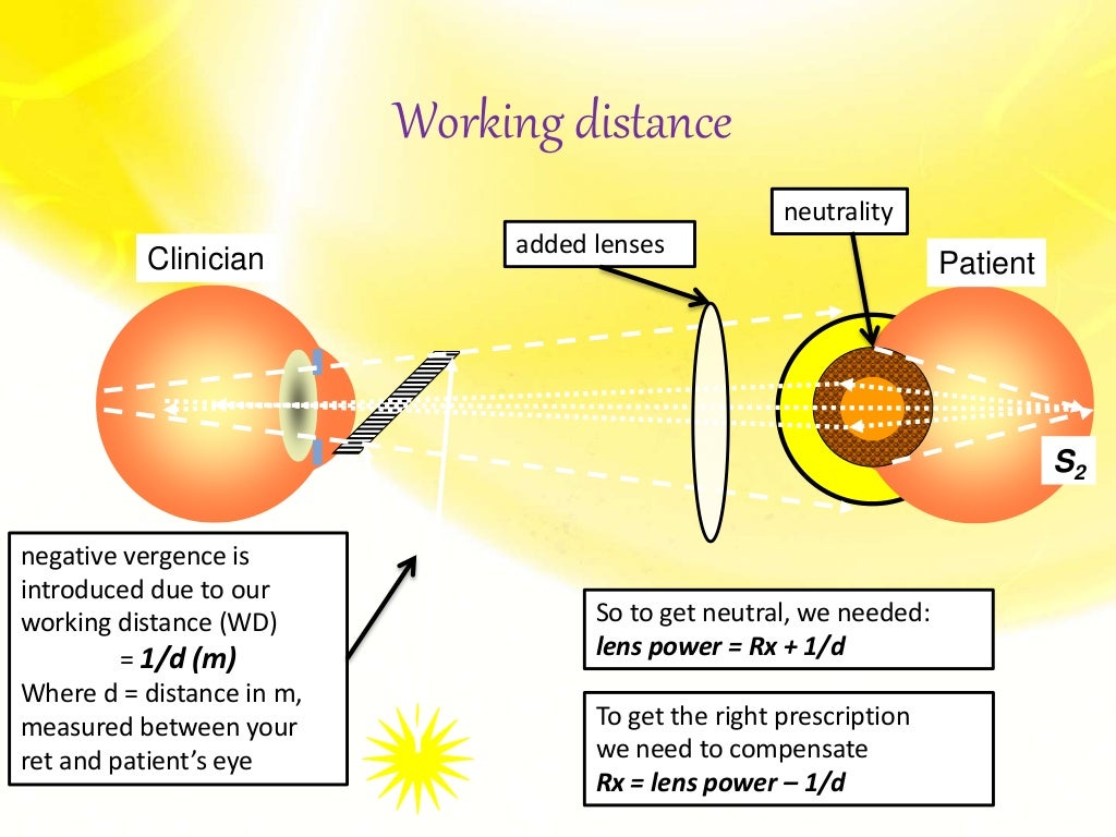 Retinoscopy/ Objective Refraction / Retinoscopy of eye (Principle