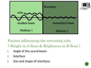 Factors influencing the returning echo
( Height in A-Scan & Brightness in B-Scan )
1. Angle of the sound beam
2. Interface
3. Size and shape of interfaces
 