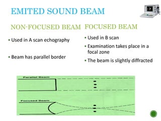 EMITED SOUND BEAM
NON-FOCUSED BEAM
 Used in A scan echography
 Beam has parallel border
FOCUSED BEAM
 Used in B scan
 Examination takes place in a
focal zone
 The beam is slightly diffracted
 