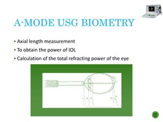 A-MODE USG BIOMETRY
 Axial length measurement
 To obtain the power of IOL
 Calculation of the total refracting power of the eye
 