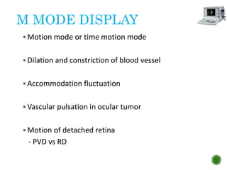 M MODE DISPLAY
 Motion mode or time motion mode
 Dilation and constriction of blood vessel
 Accommodation fluctuation
 Vascular pulsation in ocular tumor
 Motion of detached retina
- PVD vs RD
 
