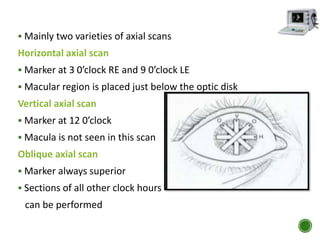  Mainly two varieties of axial scans
Horizontal axial scan
 Marker at 3 0’clock RE and 9 0’clock LE
 Macular region is placed just below the optic disk
Vertical axial scan
 Marker at 12 0’clock
 Macula is not seen in this scan
Oblique axial scan
 Marker always superior
 Sections of all other clock hours
can be performed
 