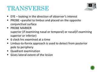 TRANSVERSE
 EYE – looking in the direction of observer’s interest
 PROBE –parallel to limbus and placed on the opposite
conjunctival surface
 PROBE MARKER
superior (if examining nasal or temporal) or nasal(if examining
superior or inferior)
 6 clock hrs examined at a time
 Limbus-to-fornix approach is used to detect from posterior
pole to periphery
 Quadrant examination
 Gives lateral extent of the lesion
 