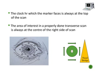  The clock hr which the marker faces is always at the top
of the scan
 The area of interest in a properly done transverse scan
is always at the centre of the right side of scan
Nasal
Bridge
 