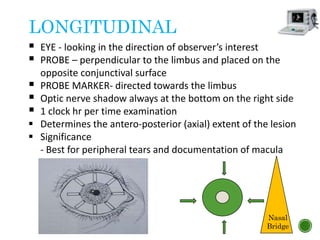 LONGITUDINAL
 EYE - looking in the direction of observer’s interest
 PROBE – perpendicular to the limbus and placed on the
opposite conjunctival surface
 PROBE MARKER- directed towards the limbus
 Optic nerve shadow always at the bottom on the right side
 1 clock hr per time examination
 Determines the antero-posterior (axial) extent of the lesion
 Significance
- Best for peripheral tears and documentation of macula
Nasal
Bridge
 